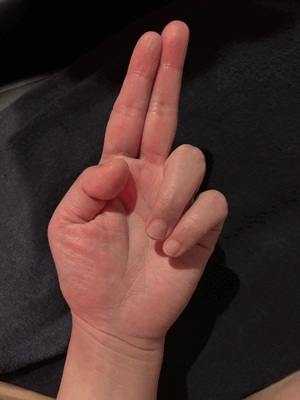 極